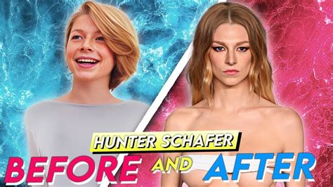 hunter schafer breast implant|Hunter Schafer’s Plastic Surgery – What We Know So。